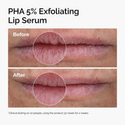 The Ordinary Lip Care Duo - Skin Care Bundle Set - PHA 5% Exfoliating Lip Serum 0.5 Fl Oz + Squalane and Amino Acids Lip Balm